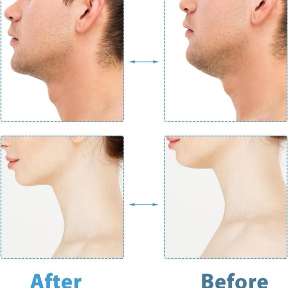 Headache Relief Products &  6 Pcs Jaw Exerciser - Picture 7 of 14